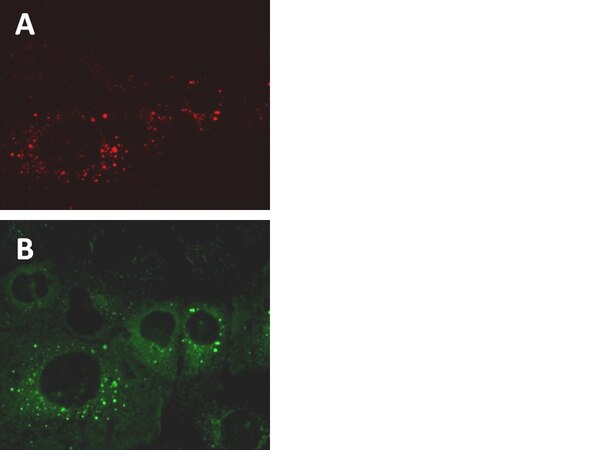 P62 Rfp LentiBrite™ RFP-p62 Lentiviral Biosensor | 17-10404
